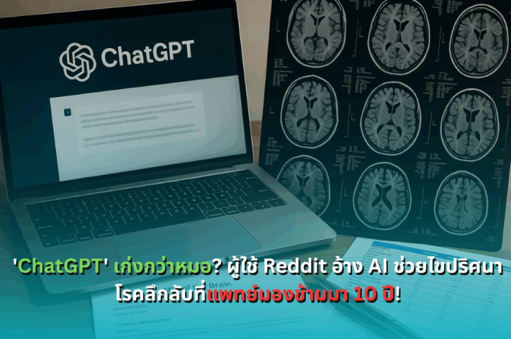 'ChatGPT' เก่งกว่าหมอ? ผู้ใช้ Reddit อ้าง AI ช่วยไขปริศนาโรคลึกลับที่แพทย์มองข้ามมา 10 ปี!