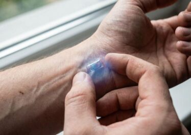 ผุดเทคฯใหม่สุดล้ำฝังชิปใต้ผิวหนังสแกนคริปโตจ่ายชำระเงิน 